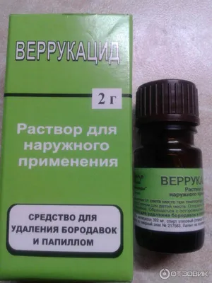 Причины появления бородавок и методы их удаления – статьи МЦ «Созвездие  здоровья»