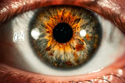 Осложнения после уколов в стекловидное тело глаза (интравитреальные  инъекции)