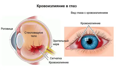 ФГАУ НМИЦ «МНТК «Микрохирургия глаза»