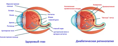 Беременность и заболевания глаз. В помощь практикующему врачу