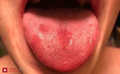 Чем опасен оральный секс для здоровья полости рта - Delfi RU