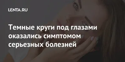 Почему могут возникать темные круги под глазами у детей: педиатр назвала  основные причины | О здоровье: с медицинского на русский | Дзен