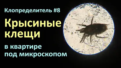 Клопределитель №8: крысиные клещи на фото и видео от нашего зрителя -  YouTube