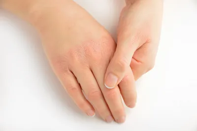 Айсида - ☝Сложно добиться ухоженного вида рук, если вас беспокоит такая  проблема, как сухость кожи. Чрезмерной сухостью кожи рук сталкиваются  многие. И это является поводом для беспокойства, 👎 особенно если в  последствии