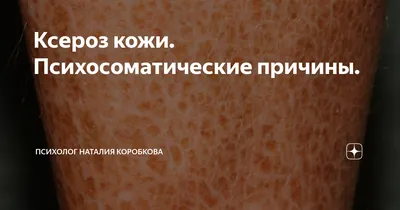 Сухая кожа головы – что делать? | Лечение и увлажнение очень ухой кожи  головы в IHC