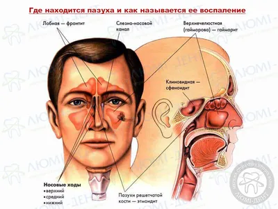 КТ придаткових пазух носа у Львові ≡ Ціна, запис в Центр NOVO