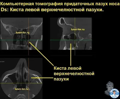 Компьютерная томография околоносовых пазух: доступные цены, онлайн-запись