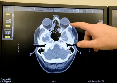Компьютерная томография придаточных пазух носа - Клиника Здоровье 365 г.  Екатеринбург