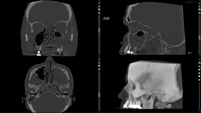 https://tonuspremium.ru/diagnosticheskij-centr/kompjuternaja-tomografija/kt-okolonosovyh-pazuh/