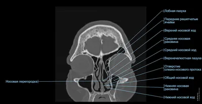 Компьютерная томография околоносовых пазух в Москве на современном  оборудовании