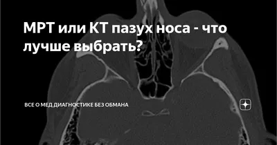 КТ придаточных пазух носа в Киеве ~ МЕДИКОМ