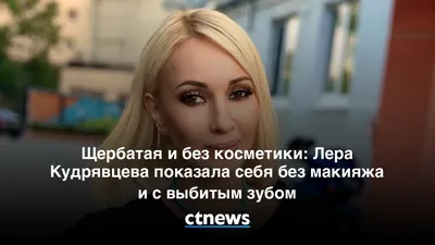 Без слез не взглянешь»: Кудрявцева призналась, почему ретуширует все свои  фото