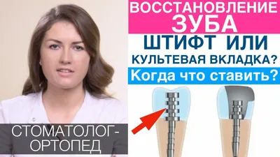 Фотографии металлических культевых вкладок