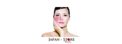 Лечение купероза на лице лазером: отзывы, фото | Beauty Insider