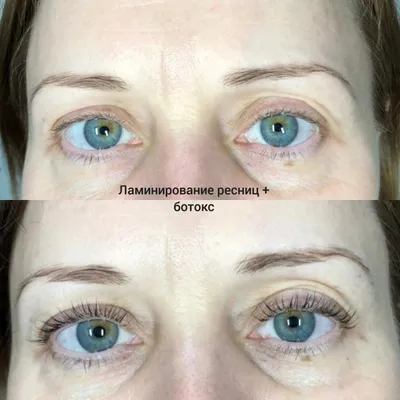 Ламинирование ресниц LVL Lashes - «Мой ЧЕСТНЫЙ отзыв! ✦ Ламинирование ресниц  с эффектом на 3 дня и деньги выброшенные в мусорное ведро ✦ СРАВНЕНИЕ  процедур: Ботокс или Ламинирование - в чём разница?? » | отзывы