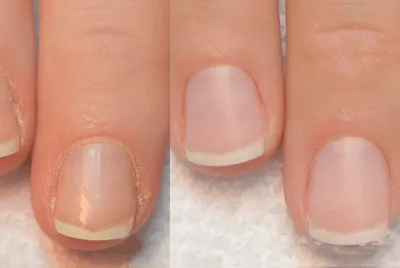 LCN, Гель с кератином для ламинирования ногтей, Natural Nail Boost Gel  Keratin, 10 мл. - купить в интернет-магазине ПРОФМИКС