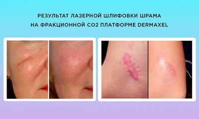 Комплекс услуг по различной проблематике | Клиника эстетической медицины  Esthetique