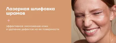 Лазерная шлифовка лица в Москве | Damas Medical Center