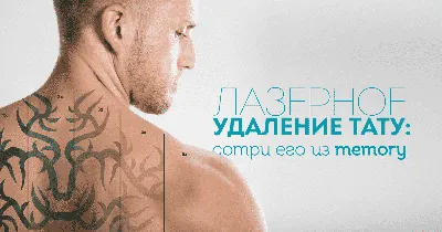 Удаление татуировки лазером: цены в Новосибирске, услуги сведения, удаления  тату неодимовым лазером, стоимость