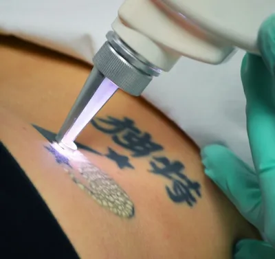 Уход за кожей после выведения татуировки или татуажа | блог Permanent Profy  - Permanent Profy