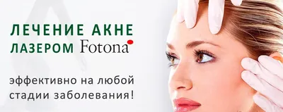 Лечение акне: история Елены Воронцовой - COSMOPRO — Косметологическая  клиника
