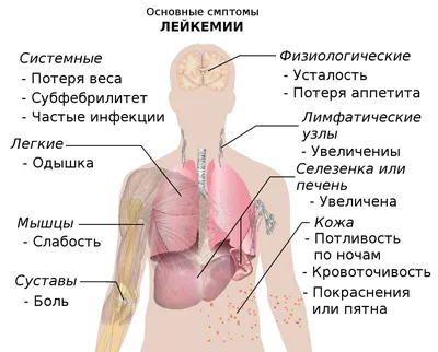 Состояние кожи может предупредить о лейкемии - МОГИЛЕВСКИЙ ФОРУМ