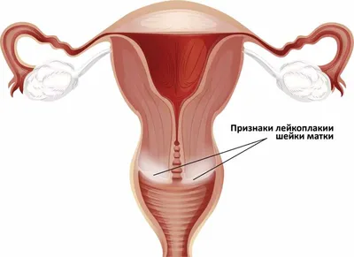 ВИЧ-инфекция: проявления в области рта при СПИДеDENTALMAGAZINE.RU