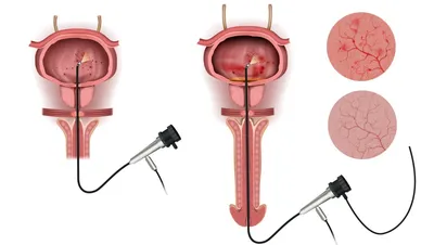 RF-лифтинг лица в клинике Dekamedical Альтернатива хирургической подтяжке  лица. в Москве