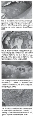 Дентал Юг, ноябрь 2009, 11 (71) by Dental Magazine - Issuu