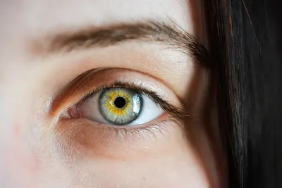 Реально ли заставить ленивый глаз снова нормально видеть? | Пикабу