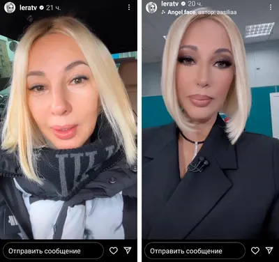 Лера Кудрявцева опубликовала свое видео без макияжа и фильтров | РБК Life