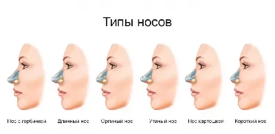 Леваторопластики или как сново стать полноценной женщиной | Пикабу