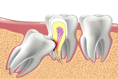 Ортодонтия разное
