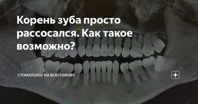 Зубы мудрости — нужны ли нам восьмерки. Полезная информация. Стоматология  «Практика доктора Склярука»