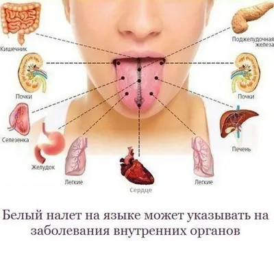 Нарушение пигментации кожи - пигментные пятна на теле, депигментация:  причины, как избавиться