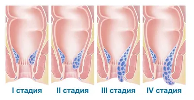 Врач эндокринолог в Новосибирске — цена приема от 2200 руб., запись в  клинике Duet Cliniс