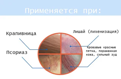 Контактный дерматит: причины и симптомы - meds.ru