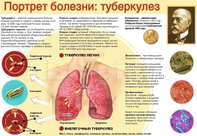 Презентация на тему: \"Туберкулёз кожи Выполнила студентка 4 группы 4 курса  стоматологического факультета Пензина Д.Э. ФГБОУ ВО Саратовский ГМУ им.  В.И.Разумовского Минздравсоцразвития.\". Скачать бесплатно и без регистрации.