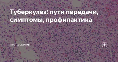 ВСЕМИРНЫЙ ДЕНЬ БОРЬБЫ С ТУБЕРКУЛЕЗОМ | Городская поликлиника №72