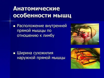 Татуаж глаз в Светлогорске: 15 мастеров татуажа с отзывами и ценами на  Яндекс Услугах.