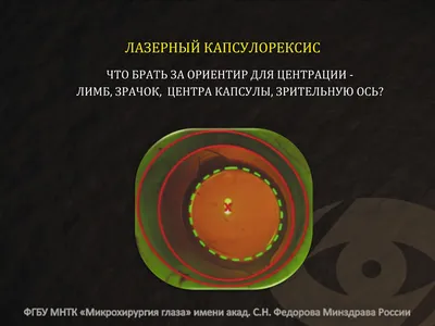 Ответы Mail.ru: НЕЧЕТКИЙ ЛИМБ ГЛАЗА (у человека), ЧТО ЭТО? это заболевание?  ОН ПРАКТИЧЕСКИ ОТСУТСТВУЕТ.