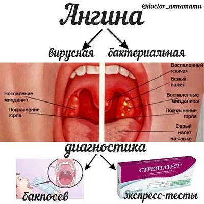 Почему першит в горле - Рамблер/доктор