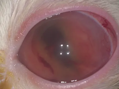 Рак глаза: внутриглазная меланома - Maximed Турция | Guides