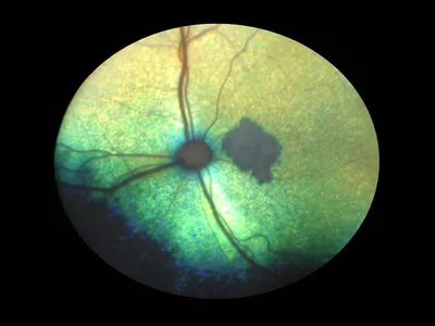 Современное лечение онкологии глазами пациента (и фотки внутри) | Пикабу