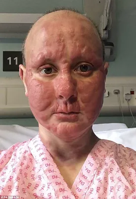 34-летняя мама, у которой рак: Я прячусь от детей — пусть запомнят меня  красивой