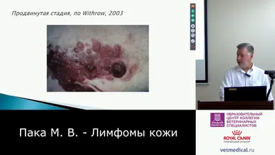 Фиброма кожи: диагностика, лечение, удаление опухоли в Москве