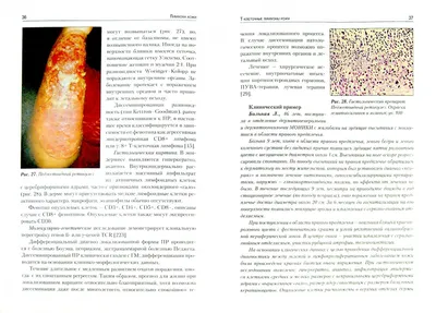 Иллюстрация 7 из 14 для Лимфомы кожи. Диагностика и лечение - Потекаев,  Виноградова, Виноградов | Лабиринт - книги.