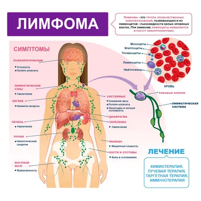 Дерматоскопия в диагностике кожных лимфом, часть I