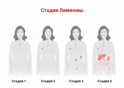 Контактный дерматит - Консультация Дерматолога Онлайн