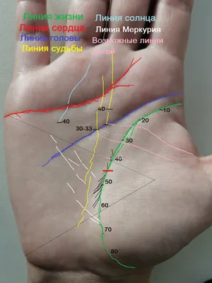 УЗИ лучезапястного сустава и кисти руки в СПб | Клиника МедПросвет